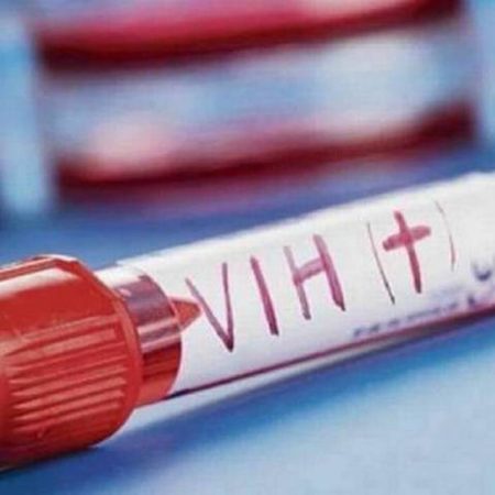 VIH o SIDA ¿Cuál es la diferencia y cómo cuidarse para no contraerlas? – El Heraldo de Tabasco